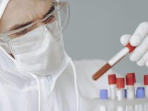 Roche bringt Corona-Schnelltest noch im September auf den Markt, Dating-App Bumble plant Milliarden-Börsengang, Kodak-Aktie steigt in 23 Stunden um 70 Prozent